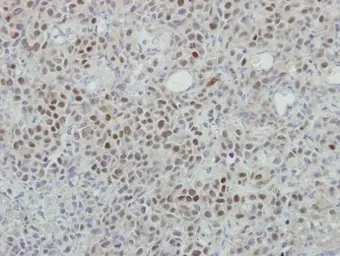 Anti-MINA53 antibody [N1N3] used in IHC (Paraffin sections) (IHC-P). GTX118937