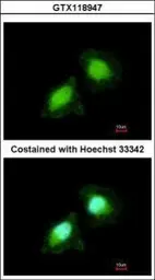 Anti-AIMP2 antibody [N1C1] used in Immunocytochemistry/ Immunofluorescence (ICC/IF). GTX118947