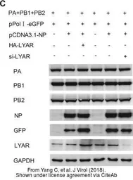 Anti-Influenza A virus PA protein antibody used in Western Blot (WB). GTX118991