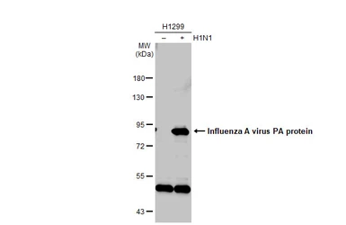 Anti-Influenza A virus PA protein antibody used in Western Blot (WB). GTX118991