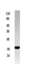 Human LC3 protein, His tag. GTX118992-pro