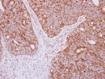Anti-YARS2 antibody used in IHC (Paraffin sections) (IHC-P). GTX119009