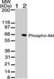 Anti-AKT (phospho Ser473) antibody [104A282] used in Western Blot (WB). GTX11901