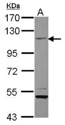 Anti-PTPRH antibody [C2C3], C-term used in Western Blot (WB). GTX119064