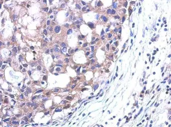 Anti-SRM antibody [N1C2] used in IHC (Paraffin sections) (IHC-P). GTX119072