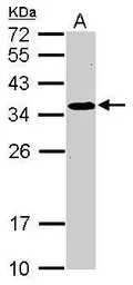 Anti-SRM antibody [N1C2] used in Western Blot (WB). GTX119072