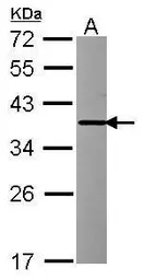 Anti-INMT antibody [N1C3] used in Western Blot (WB). GTX119115