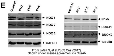 Anti-DUOX1 antibody [N1N3] used in Western Blot (WB). GTX119160