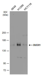 Anti-DUOX1 antibody [N1N3] used in Western Blot (WB). GTX119160