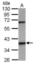 Anti-LHX5 antibody [N2C2], Internal used in Western Blot (WB). GTX119209