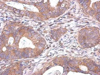 Anti-C20orf7 antibody [N3C3] used in IHC (Paraffin sections) (IHC-P). GTX119214