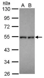 Anti-DPF1 antibody used in Western Blot (WB). GTX119318