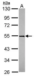 Anti-TRIM49 antibody [N1C1] used in Western Blot (WB). GTX119323
