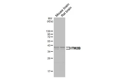 Anti-ITM2B antibody used in Western Blot (WB). GTX119361