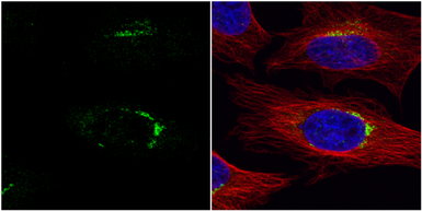 Anti-VPS33A antibody [C1C3] used in Immunocytochemistry/ Immunofluorescence (ICC/IF). GTX119416