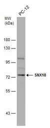 Anti-SNX18 antibody used in Western Blot (WB). GTX119426