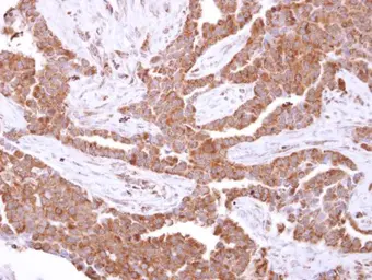Anti-Glutathione S-transferase kappa 1 antibody [N1C2] used in IHC (Paraffin sections) (IHC-P). GTX119447