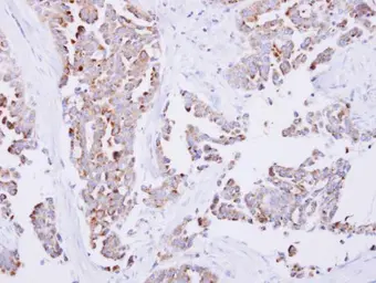 Anti-SARS2 antibody [N3C2], Internal used in IHC (Paraffin sections) (IHC-P). GTX119451