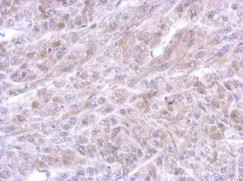 Anti-Annexin VIII antibody [N1C2] used in IHC (Paraffin sections) (IHC-P). GTX119470