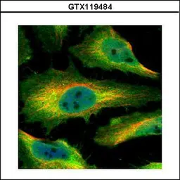 Anti-SMYD1 antibody used in Immunocytochemistry/ Immunofluorescence (ICC/IF). GTX119484