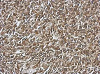 Anti-SMYD1 antibody used in IHC (Paraffin sections) (IHC-P). GTX119484