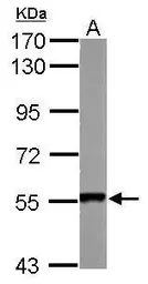 Anti-SMYD1 antibody used in Western Blot (WB). GTX119484