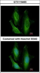 Anti-STBD1 antibody [N1C3] used in Immunocytochemistry/ Immunofluorescence (ICC/IF). GTX119493
