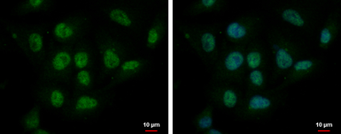 Anti-CBX6 antibody used in Immunocytochemistry/ Immunofluorescence (ICC/IF). GTX119535