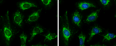 Anti-Pyruvate Dehydrogenase E1 beta subunit antibody used in Immunocytochemistry/ Immunofluorescence (ICC/IF). GTX119625