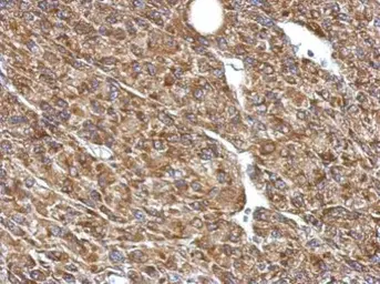 Anti-Pyruvate Dehydrogenase E1 beta subunit antibody used in IHC (Paraffin sections) (IHC-P). GTX119625