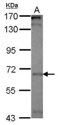 Anti-CALM antibody used in Western Blot (WB). GTX119631