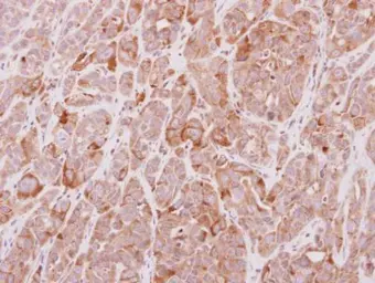 Anti-MGAT4A antibody [C1C3] used in IHC (Paraffin sections) (IHC-P). GTX119640