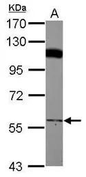 Anti-PCYOX1 antibody used in Western Blot (WB). GTX119652
