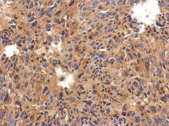 Anti-C1 inhibitor antibody [C1C3] used in IHC (Paraffin sections) (IHC-P). GTX119690