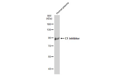 Anti-C1 inhibitor antibody [C1C3] used in Western Blot (WB). GTX119690