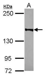 Anti-Rad50 antibody [C1C2], Internal used in Western Blot (WB). GTX119732