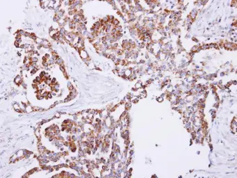 Anti-PITRM1 antibody used in IHC (Paraffin sections) (IHC-P). GTX119739
