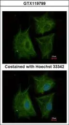 Anti-AGBL4 antibody [N2C3] used in Immunocytochemistry/ Immunofluorescence (ICC/IF). GTX119799
