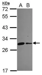 Anti-CHCHD3 antibody [N1C3] used in Western Blot (WB). GTX119821