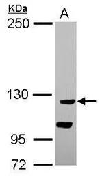 Anti-CATSPERB antibody [N1N2], N-term used in Western Blot (WB). GTX119836