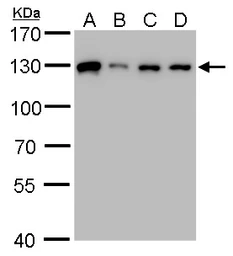 Anti-ARS2 antibody used in Western Blot (WB). GTX119872