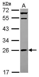 Anti-MRPS26 antibody [N1C3] used in Western Blot (WB). GTX119878