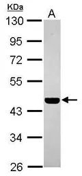 Anti-PABPC5 antibody [N1C2] used in Western Blot (WB). GTX119883