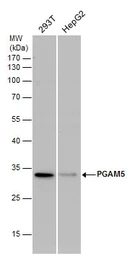 Anti-PGAM5 antibody used in Western Blot (WB). GTX119887