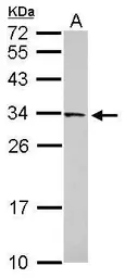 Anti-FAM78B antibody [N2C3] used in Western Blot (WB). GTX119928