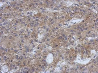 Anti-PPFIBP1 antibody used in IHC (Paraffin sections) (IHC-P). GTX119965