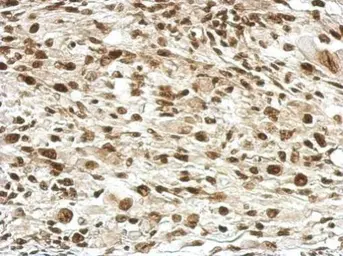 Anti-RPRD1B antibody used in IHC (Paraffin sections) (IHC-P). GTX119969
