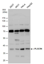 Anti-PLSCR4 antibody used in Western Blot (WB). GTX120007