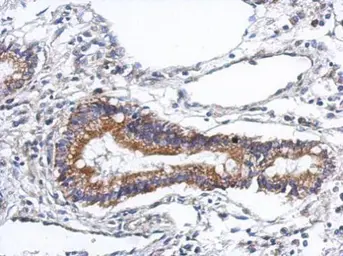 Anti-PODN antibody used in IHC (Paraffin sections) (IHC-P). GTX120026