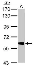 Anti-DYNC1LI1 antibody used in Western Blot (WB). GTX120114